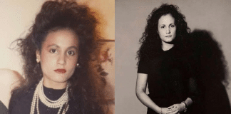 Antes e Depois! Mulher passa 40 anos sem sorrir para evitar rugas