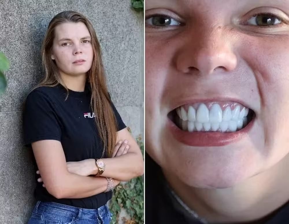 contioutra.com - Tratamento dentário barato faz mulher perder todos os dentes; saiba o que aconteceu!